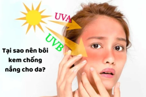 tại sao nên bôi kem chống nắng