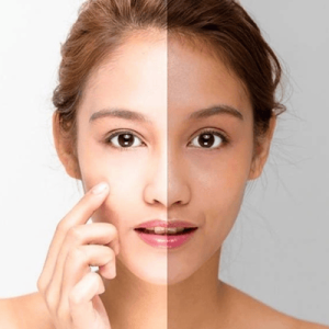 Kem dưỡng trắng da mặt giúp làm sáng da tự nhiên