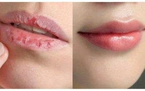 son dưỡng dhc giúp đôi môi bạn trở nên căng mọng